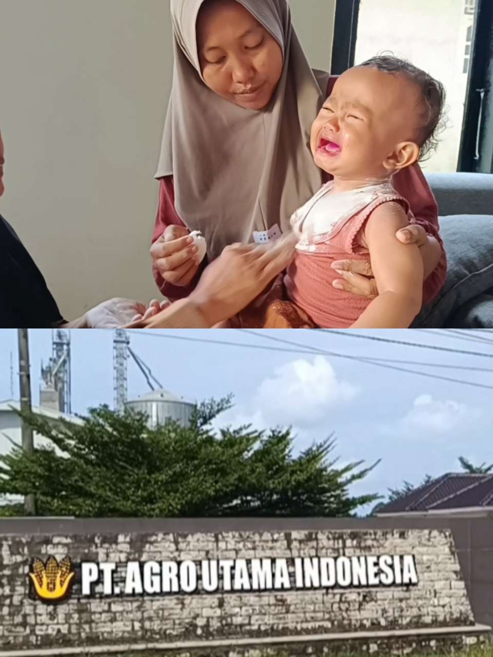 Balita menangis saat dibedaki karena gatal diduga berasal dari aktivitas usaha PT Agro Utama Indonesia